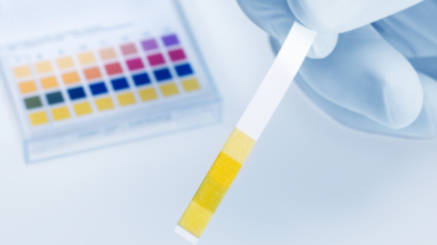 9 Yaşındaki Kısırlaştırılmış Bir Kedide İdyopatik Sistit Vakası