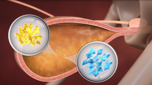 PPVD Kedi UR StOx FLUTD Video